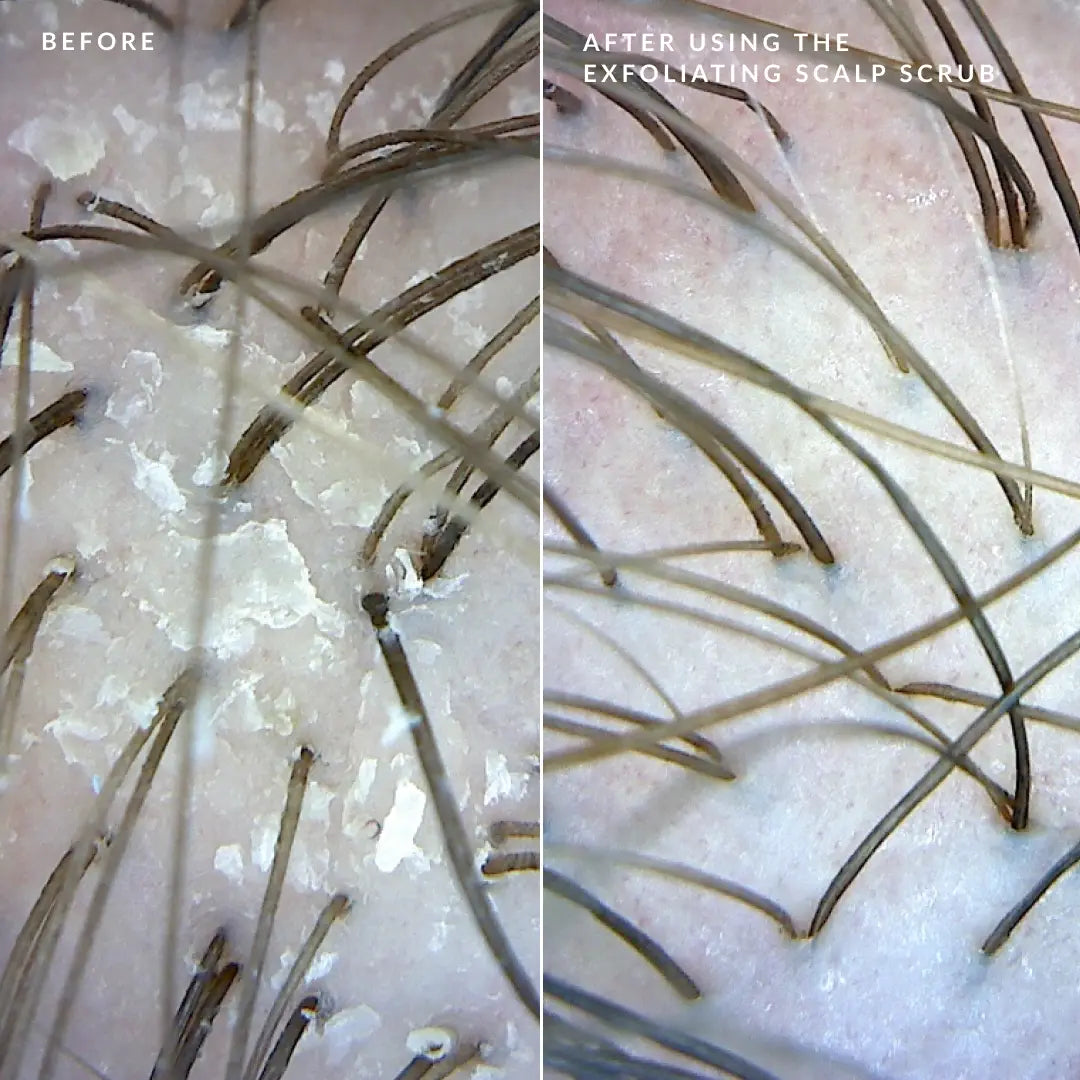 Scalp Therapy Trio