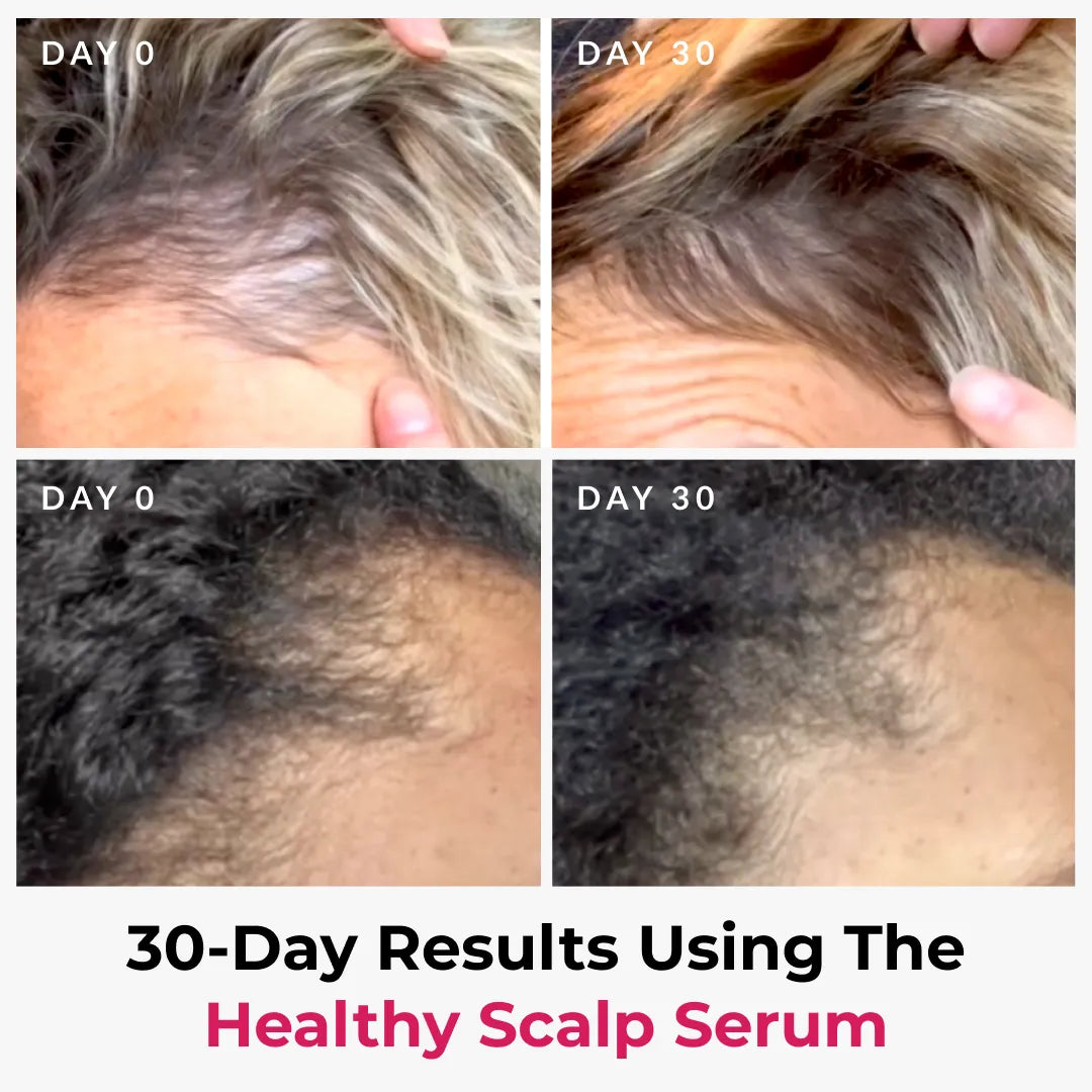 Scalp Therapy Trio