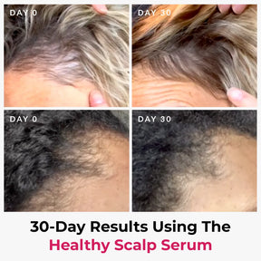 Scalp Therapy Trio