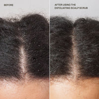 Exfoliating Scalp Scrub