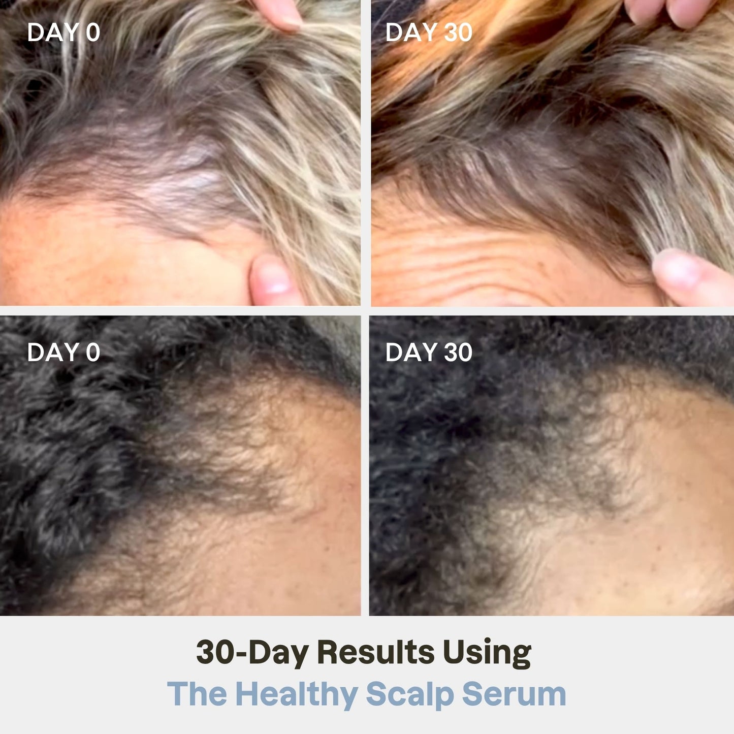 Growth & Length Repair Duo