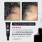 Before and after comparison of hair growth with a healthy scalp serum product on a light gray background.